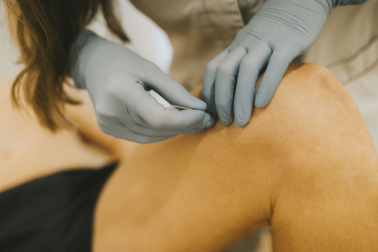 Orekaz fisioterapia punción seca